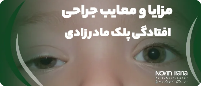 مزایا و معایب جراحی افتادگی پلک مادرزادی